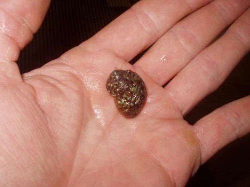 snegl.jpg